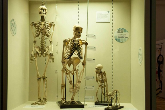Skeleton display